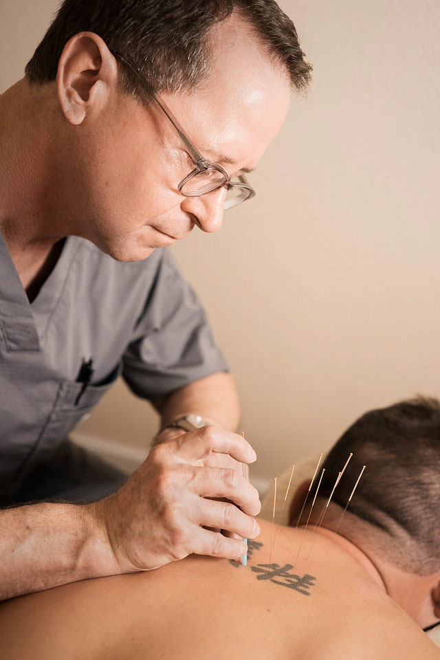 Custom sports acupuncture plans offered by Spring Acupuncture & Wellness